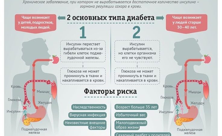 Сахарный диабет